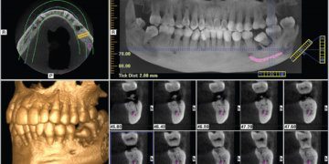 Radiographie Numérique